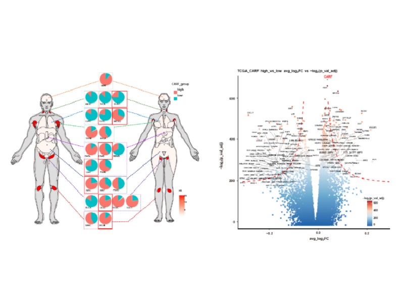 上海交大薛紅衛(wèi)教授團(tuán)隊揭示靶向磷酸化修飾的CARF作為精準(zhǔn)治療淋巴瘤的新策略